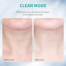 LED Photon Therapy Skin Tightener